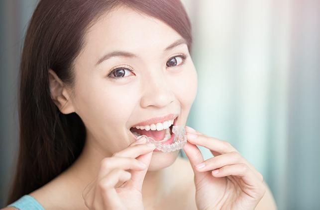 Woman placing Invisalign clear braces tray