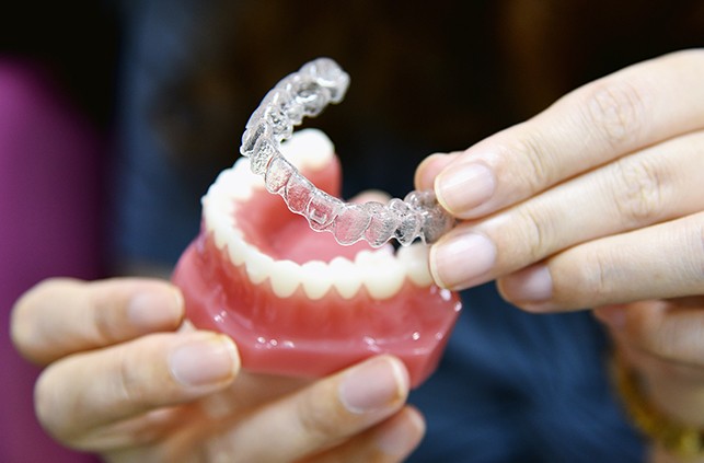 Dentist fitting Invisalign tray over model smile