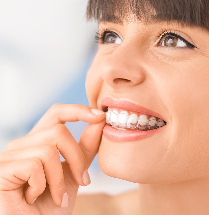 Woman placing an orthodontic appliance