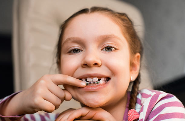 Child smiling while pointing to braces on bottom teeth