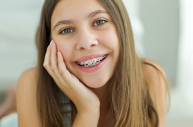 Smiling young woman with self-ligating braces