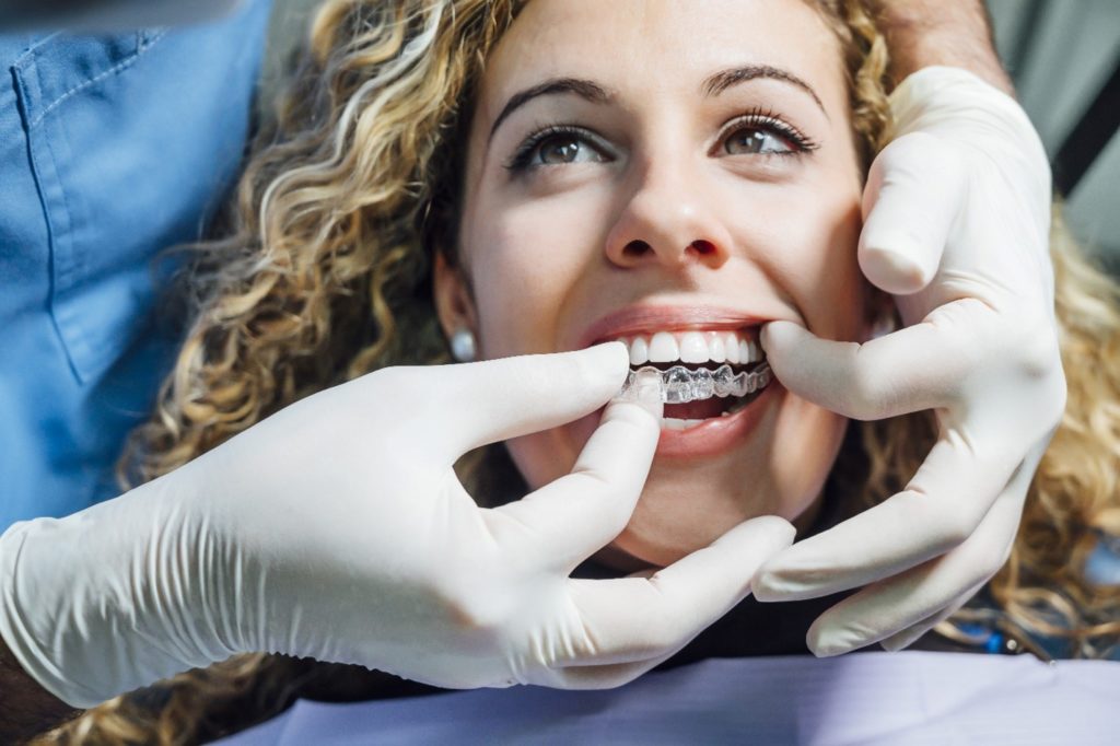 Orthodontist placing Invisalign trays on patient's teeth