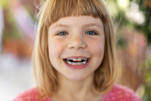 a child with braces smiling 